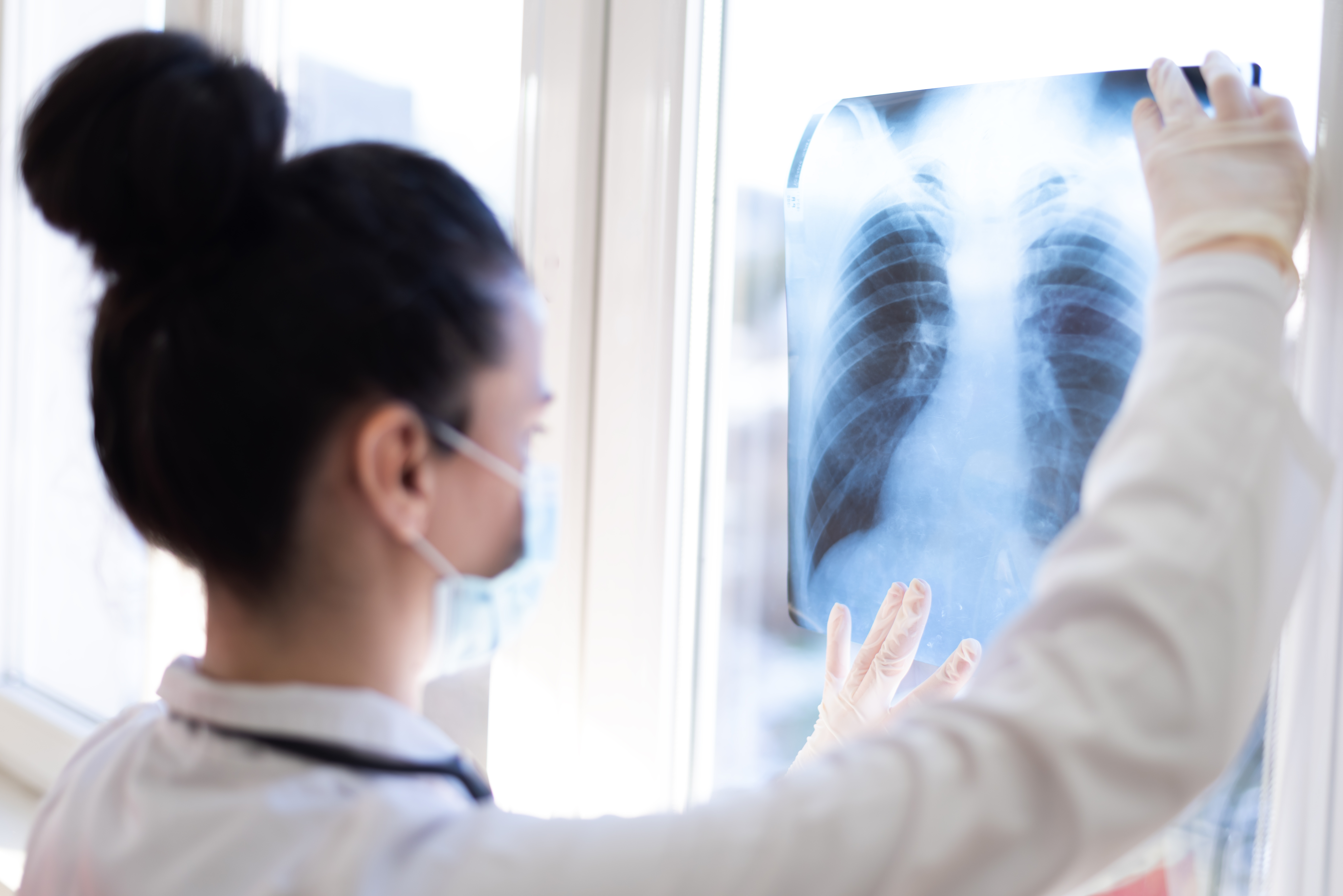 Doctor reading lung scan