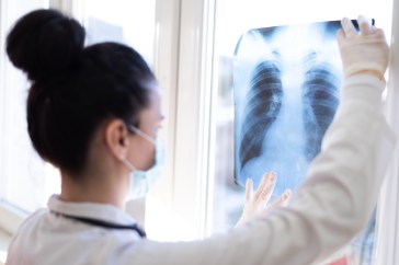 Doctor reading lung scan