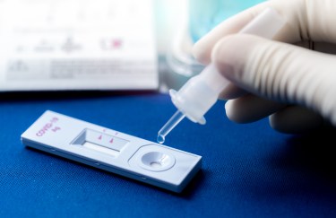 Doctor doing a COVID test by adding drops to a test strip
