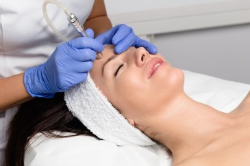 A woman getting facial microdermabrasion peeling treatment.
