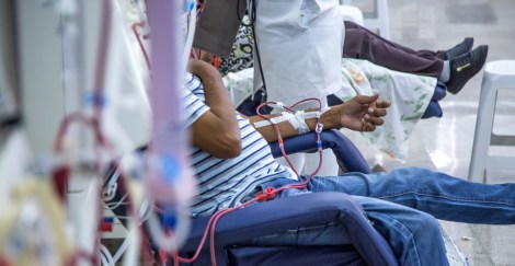 People sitting in chairs getting treatment at a medical facility.